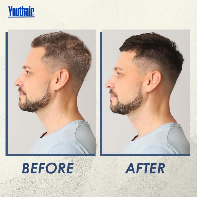 Средства линейки Youthair (ЮсХэа) позволяют восстановить природный цвет волос всего за 2-3 недели. И Вы можете сравнить вид до (слева) и после (справа) использования Youthair.
